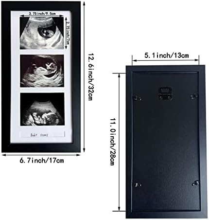trlry Тройни Рамка за УЛТРАЗВУК, Рамка за Сонограммы с 3 Снимки,Обяви за бременност,Подаръци за бременни за първи път,Подарък