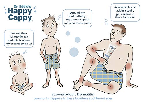 Честит Cappy Eczema Пакет | Грижа за Суха, Сърбеж, Чувствителна кожа, Склонна към екзема, за всички възрасти, за