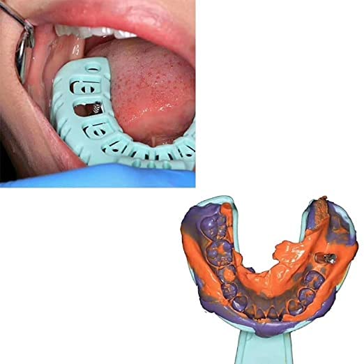 3 Двойки Тави за най-хвърля зъби за Еднократна употреба Тави за зъбни импланти Пластмасови Зелени Автоклавируемые Перфорирани