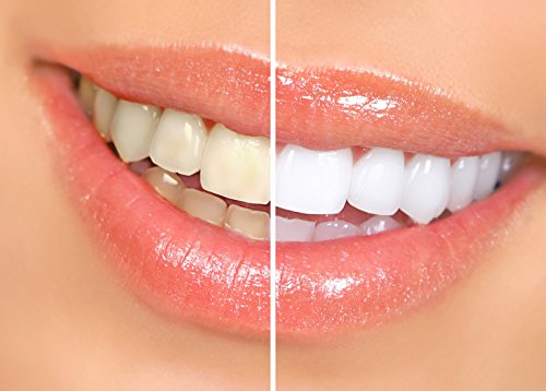 Писалка за Избелване на зъбите Dr. Smiles Pop & Prime