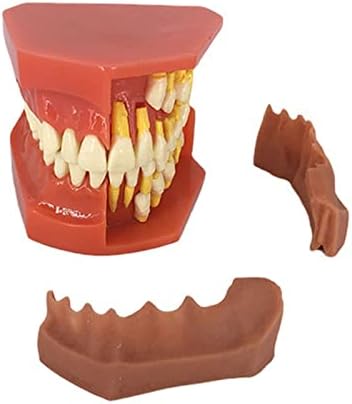 Модел на зъбите, Пародонтоза, Модел на Млечните зъби Типодонта при Деца, Демонстрационно Проучване на Зъбен